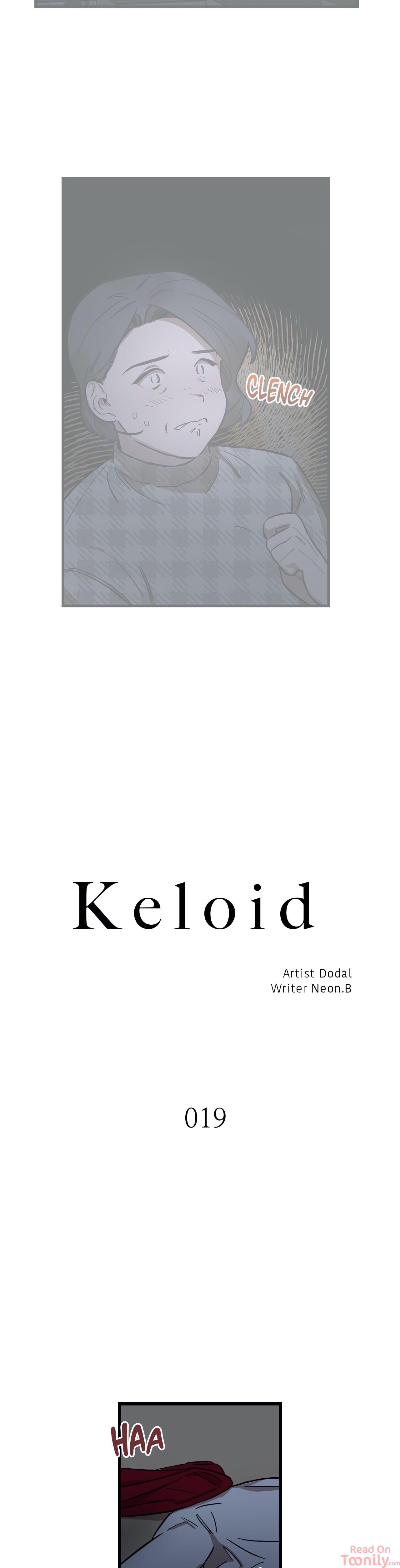 Keloid image